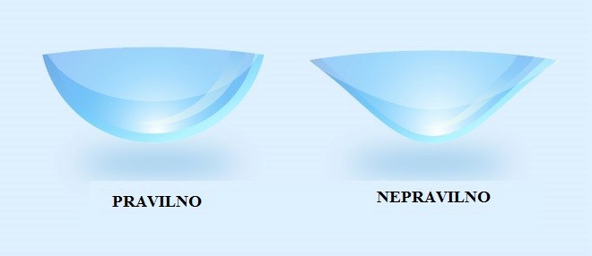 Pravilno okrenuta leća