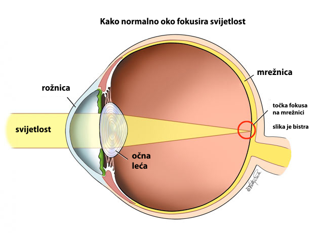 emetropno-oko