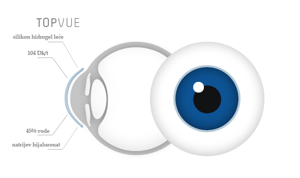 TopVue Premium